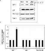 E2F1 Antibody in Western Blot (WB)