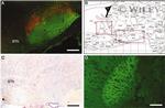 Cannabinoid Receptor 1 Antibody in Immunohistochemistry (IHC)