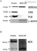 SERCA2 ATPase Antibody in Western Blot (WB)