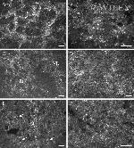 Connexin 26 Antibody in Immunohistochemistry (IHC)