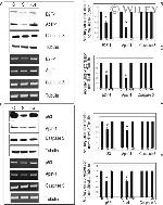 E2F1 Antibody in Western Blot (WB)