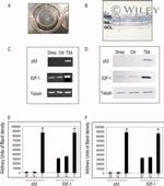 E2F1 Antibody in Western Blot (WB)