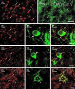 Connexin 26 Antibody in Immunohistochemistry (IHC)