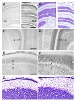 PMCA4 ATPase Antibody in Immunohistochemistry (IHC)