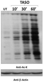 Acetylated Lysine Antibody in Western Blot (WB)