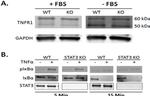 TNFR1 Antibody in Western Blot (WB)