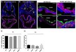 Cardiac Troponin T Antibody in Immunohistochemistry (Frozen) (IHC (F))