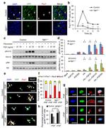 PAX7 Antibody in Immunocytochemistry (ICC/IF)