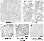 Nudel Antibody in Immunohistochemistry (Frozen) (IHC (F))