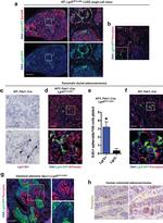 CD326 (EpCAM) Antibody in Immunohistochemistry (IHC)