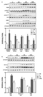 Phospho-IRE1 alpha (Ser724) Antibody in Western Blot (WB)