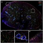 CD324 (E-Cadherin) Antibody in Immunohistochemistry (IHC)