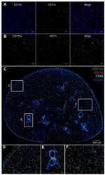 CD324 (E-Cadherin) Antibody in Immunohistochemistry (IHC)