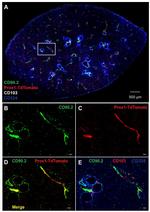 CD324 (E-Cadherin) Antibody in Immunohistochemistry (IHC)