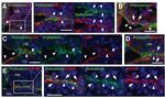 Podoplanin Antibody in Immunohistochemistry (IHC)