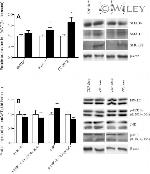 SMAD7 Antibody in Western Blot (WB)