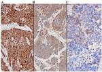 Chromogranin A Antibody in Immunohistochemistry (IHC)