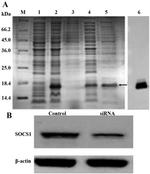 SOCS1 Antibody in Western Blot (WB)