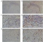 CD8 alpha Antibody in Immunohistochemistry (IHC)