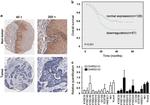 DHRS2 Antibody in Immunohistochemistry (IHC)