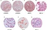 EBP50 Antibody in Immunohistochemistry (Paraffin) (IHC (P))