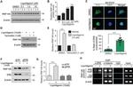 Estrogen Receptor beta Antibody in ChIP Assay (ChIP)