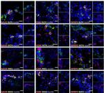 KLF4 Antibody in Immunohistochemistry (IHC)