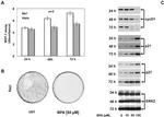 Cyclin D1 Antibody in Western Blot (WB)