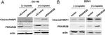 PRKAR2B Antibody in Western Blot (WB)