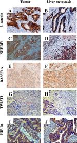 EBP50 Antibody in Immunohistochemistry (IHC)