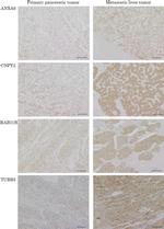 RAB11B Antibody in Immunohistochemistry (IHC)