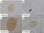 RAB11B Antibody in Immunohistochemistry (IHC)