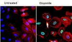 Phospho-ATM (Ser1981) Antibody in Immunocytochemistry (ICC/IF)