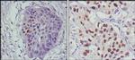 p53 Antibody in Immunohistochemistry (Paraffin) (IHC (P))