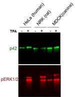 Phospho-ERK1/ERK2 (Thr185, Tyr187) Antibody in Western Blot (WB)