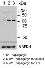 Phospho-IRE1 alpha (Ser724) Antibody