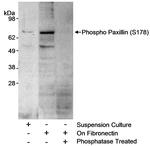 Phospho-Paxillin (Ser178) Antibody in Western Blot (WB)