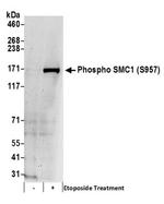 Phospho-SMC1 (Ser957) Antibody in Western Blot (WB)