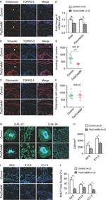 Endomucin Antibody in Immunohistochemistry (IHC)