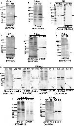 KCNMB1 Antibody in Western Blot (WB)