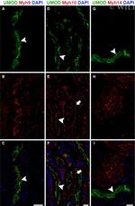 Uromodulin Antibody in Immunohistochemistry (IHC)