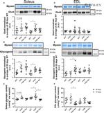 GLUT4 Antibody in Western Blot (WB)