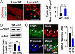 O-linked N-acetylglucosamine (O-GlcNAc) Antibody in Immunohistochemistry (IHC)