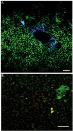 Texas Red Antibody in Immunohistochemistry (IHC)