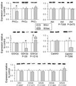 Phospho-NMDAR2B (Ser1480) Antibody in Western Blot (WB)