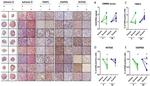 Aggrecan Neo Antibody in Immunohistochemistry (IHC)