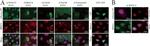 Nucleolin Antibody in Immunocytochemistry (ICC/IF)