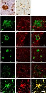 beta Amyloid Antibody in Immunohistochemistry (Frozen) (IHC (F))