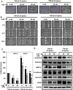 beta Catenin Antibody in Western Blot (WB)