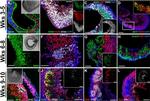 HuC/HuD Antibody in Immunocytochemistry (ICC/IF)